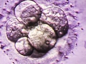 试管长方案和拮抗剂方案哪个好？附北京家园医院试管费用明细