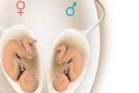 2026年想去雷州市做试管婴儿需要准备哪些事？详细收费明细一览